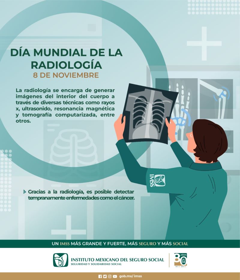 Reconoce IMSS Hidalgo importante contribución de Radiología en la medicina