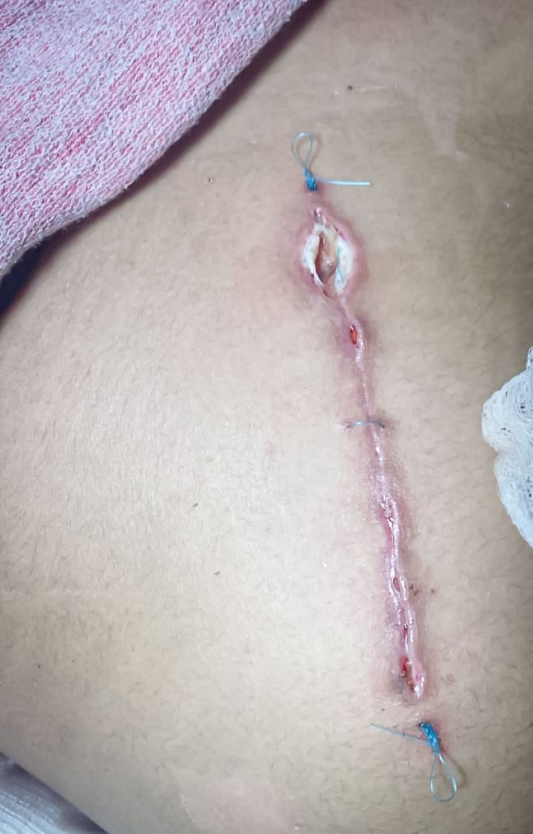 Promueve SSH Medidas Preventivas Contra Accidentes e Infecciones