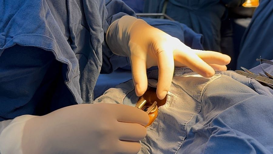 Realiza IMSS Hidalgo procuración multiorgánica en Hospital General de Zona con Medicina Familiar (HGZ/MF) No. 1 de Pachuca