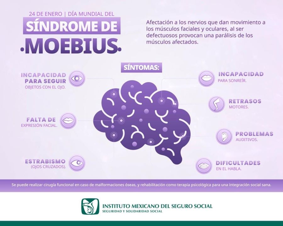 Promueve IMSS Hidalgo Atención Integral para Pacientes con Síndrome de Moebius
