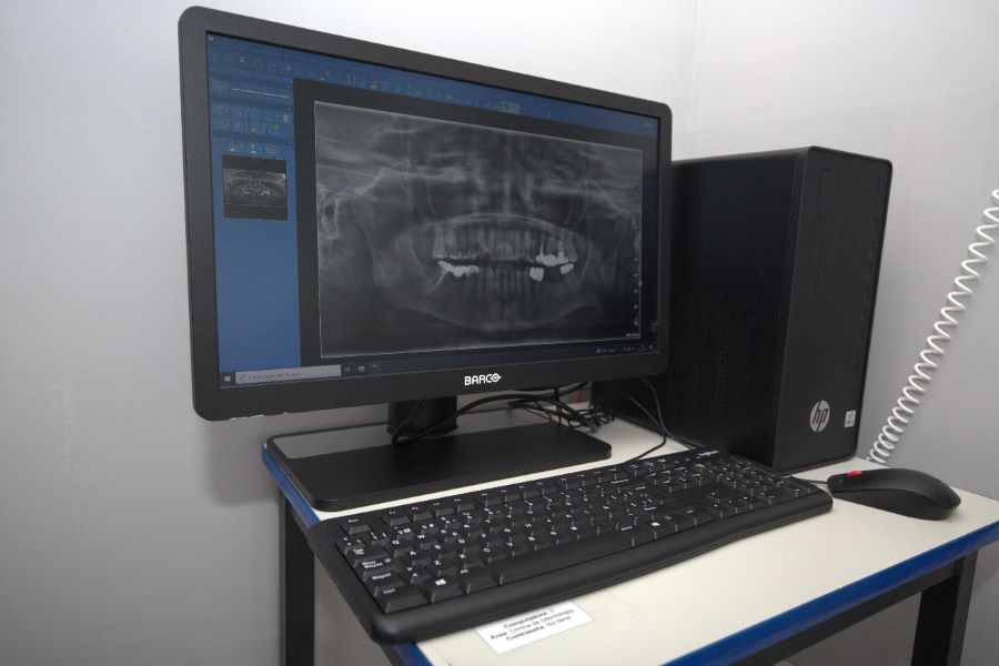 Clínicas Odontológicas de la UAEH Ofrecen Servicios Especializados y Accesibles