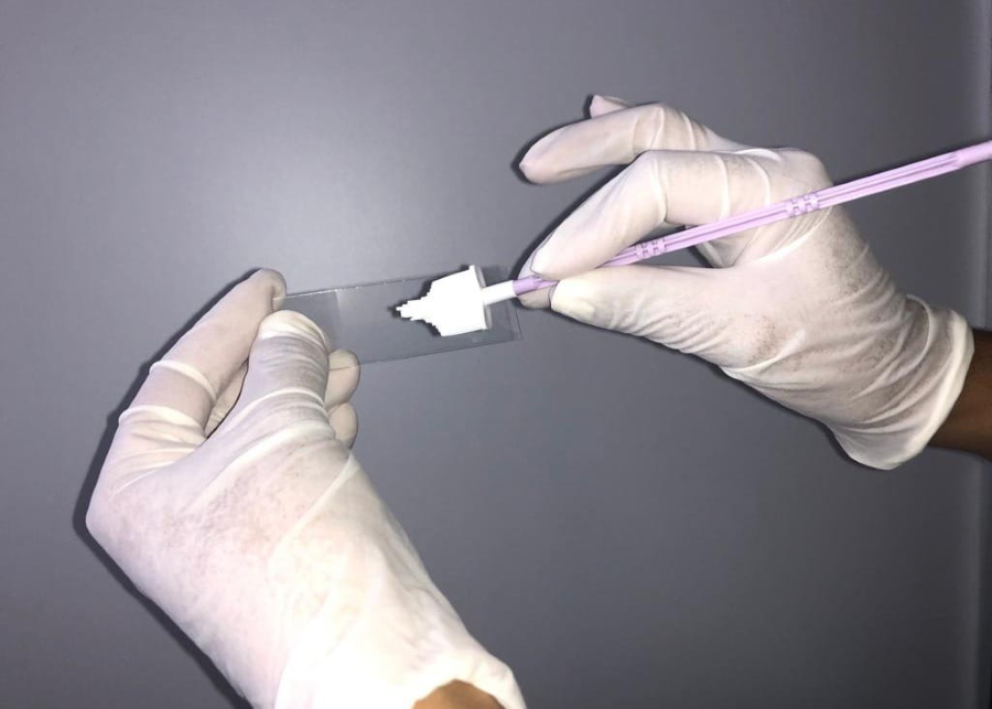 Invita ISSSTE Hidalgo a Mujeres en General a Realizarse El Estudio de Papanicolaou