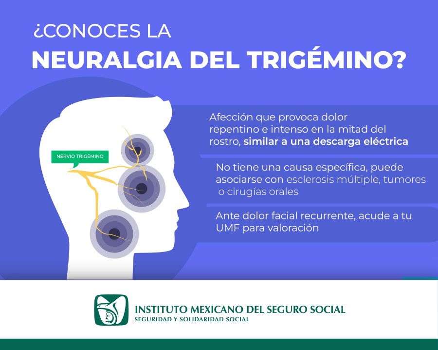 Concientiza IMSS Hidalgo Sobre Importancia de Atención Temprana de Neuralgia trigeminal