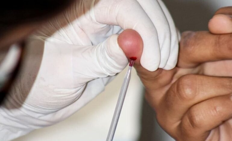 Con Servicios Integrales, Hidalgo Garantiza Atención a Personas Con VIH-Sida