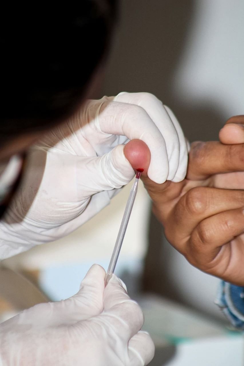 Con Servicios Integrales, Hidalgo Garantiza Atención a Personas Con VIH-Sida