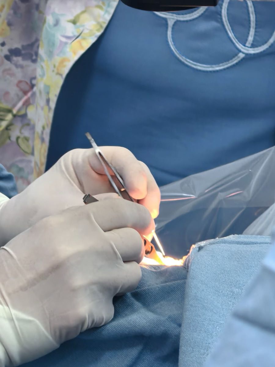 IMSS Bienestar Reactiva Trasplantes de Córnea en Hidalgo Con Dos Procedimientos de Alta Especialidad