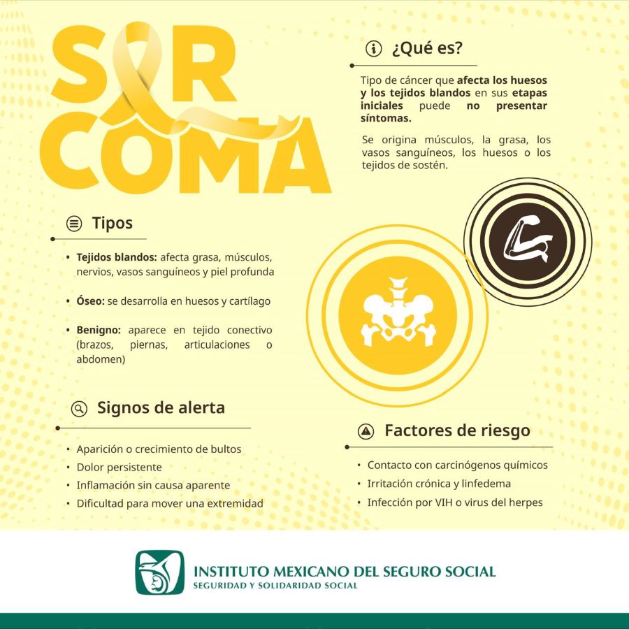 Advierte IMSS Hidalgo Sobre Signos y Síntomas de Sarcoma, un Tipo de Cáncer Relacionado con Huesos y Tejidos