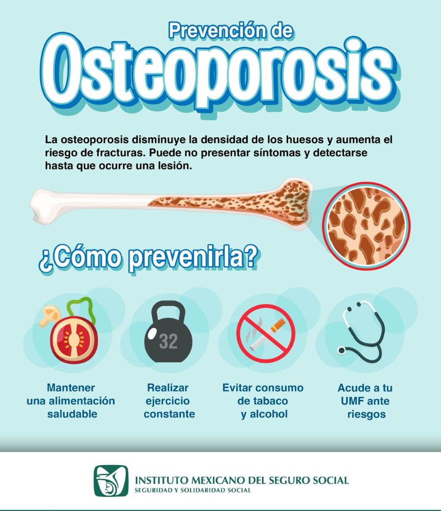 Llama IMSS Hidalgo a mantener hábitos saludables para prevenir osteoporosis