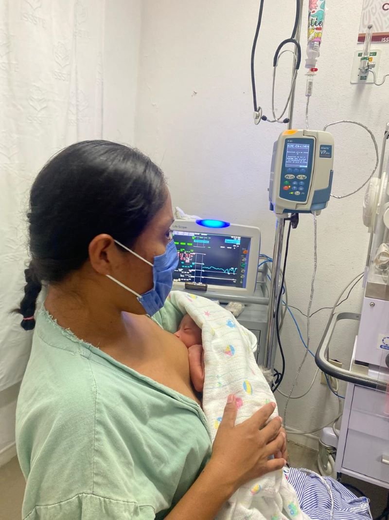 Clínica Hospital “Huejutla” del ISSSTE logra salvar vida de bebé prematuro de 32 semanas de gestación