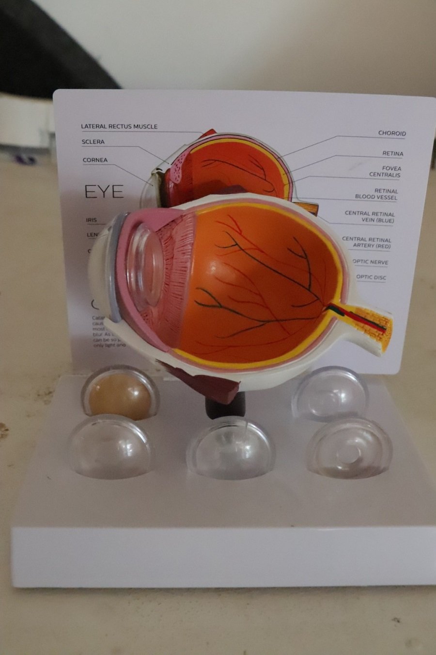 Desarrolla UPT Sistema de Bajo Costo Para Mejorar Imágenes de Retina