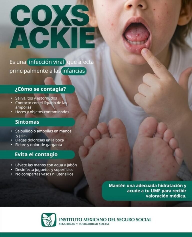 Emite IMSS Hidalgo recomendaciones para prevención de enfermedad causada por virus Coxsackie